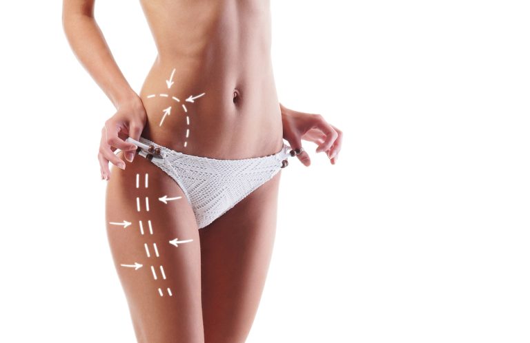 Karboksyterapia – czym jest i jak działa?